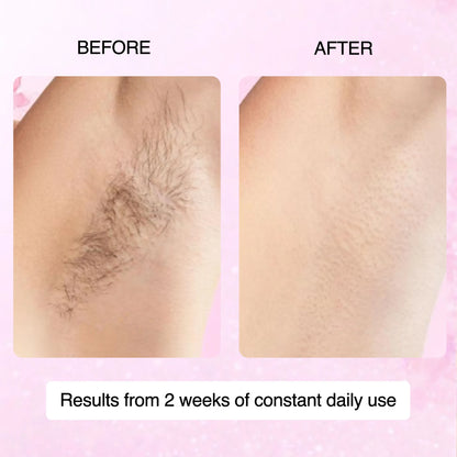 Cyperus Rotundus Skin Serum