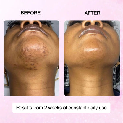Cyperus Rotundus Skin Serum